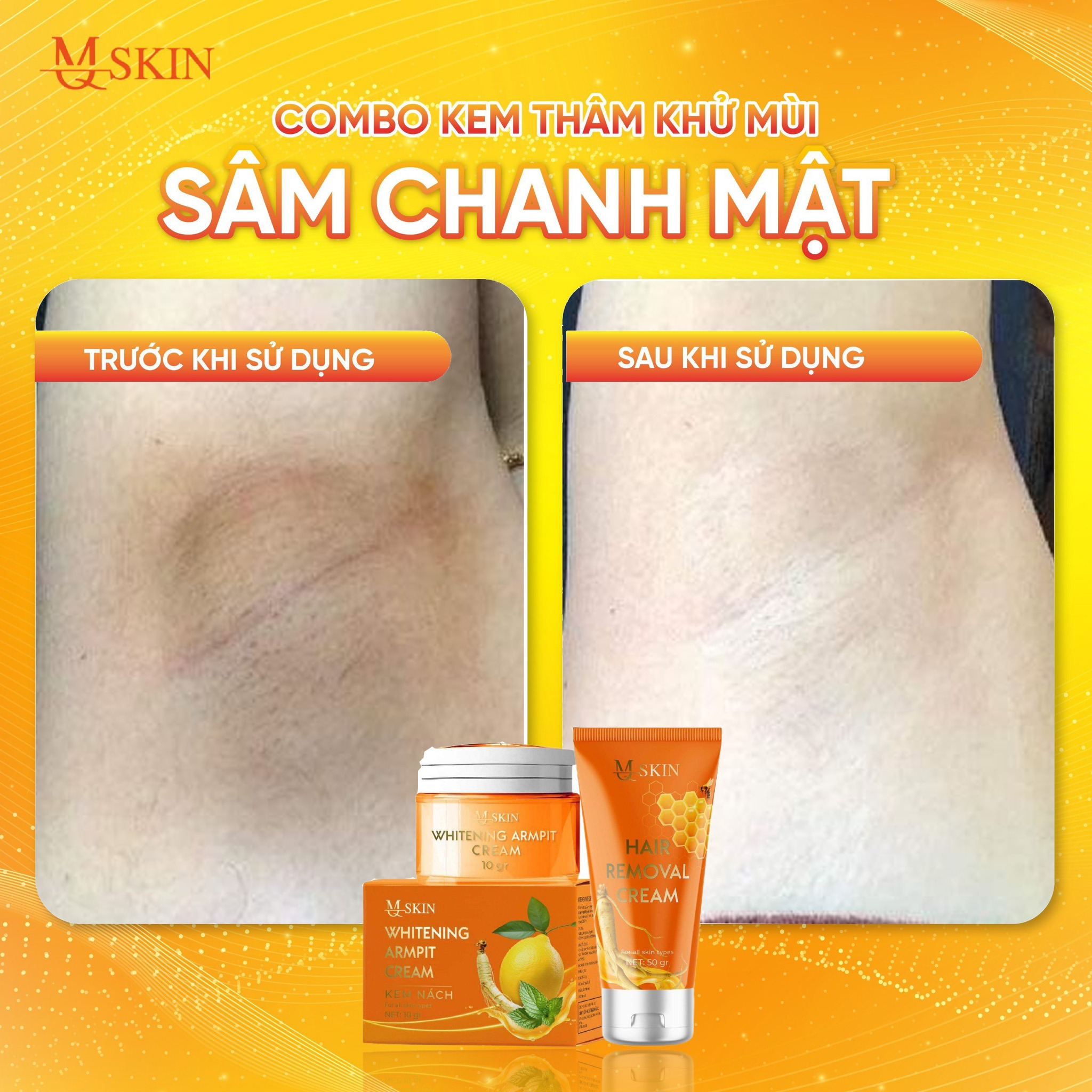 Combo Kem Tẩy Lông + Kem Thâm Nách MQ Skin Sâm Chanh Mật