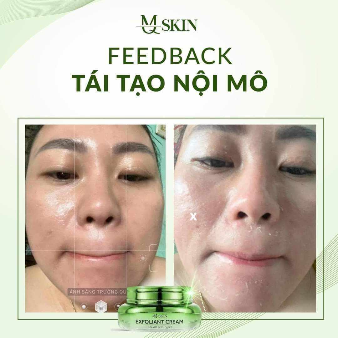 Kem Face Tái Tạo Nội Sinh Exfoliant Cream MQ Skin